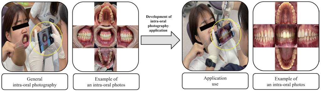 Fig. 3. Comparison of intra-oral photography results by application usage